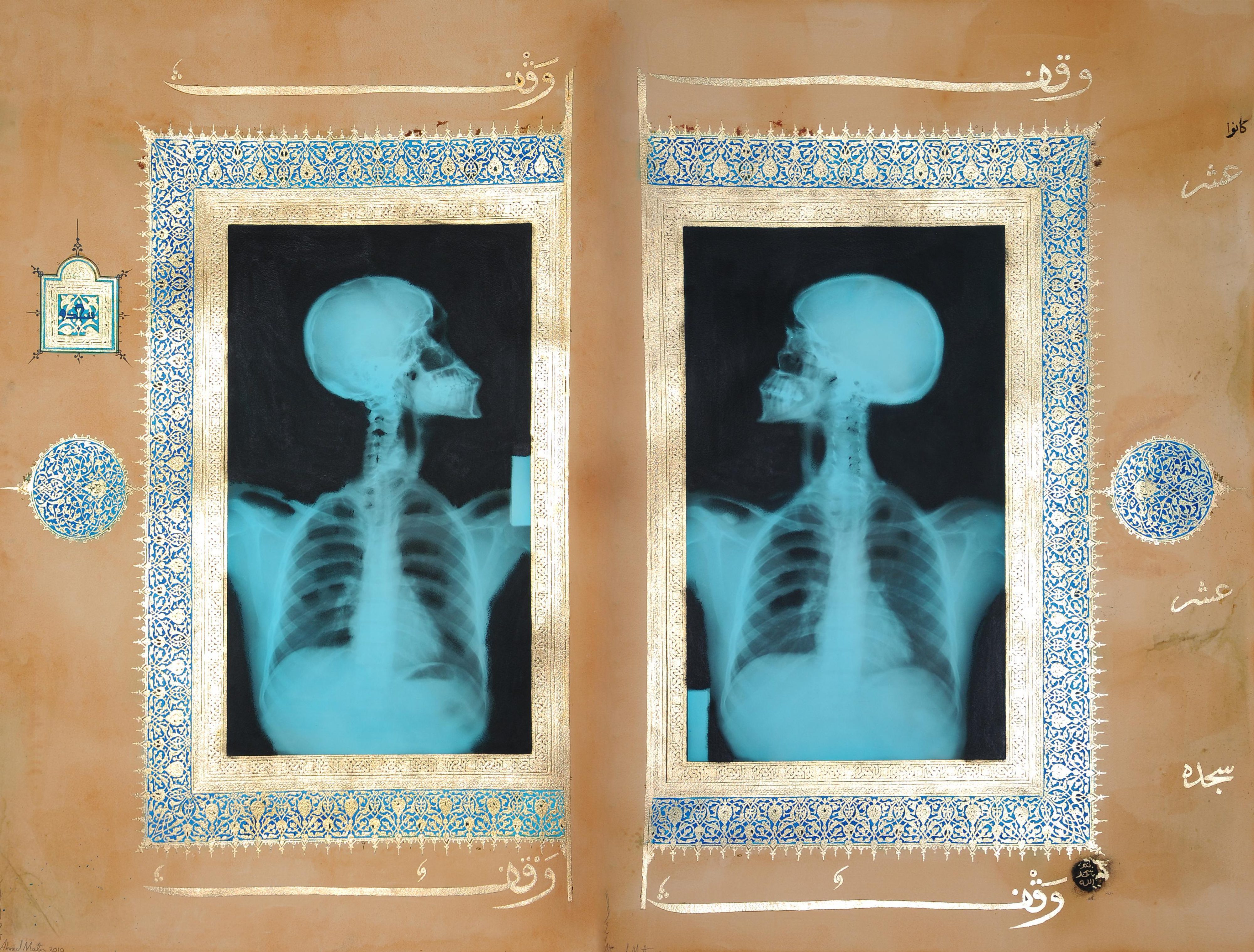 Illumination Diptych, 2008Gold leaf tea pomegranate, Dupont Chinese ink, offset X-Ray print and mixed media on archival Arche paperTwo pieces, each 165 × 110 cm